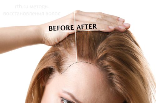 Методы восстановления волос