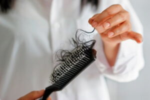 Аюрведическое лечение выпадения волос