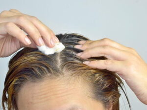 Болезни, при которых выпадают волосы, советы трихолога