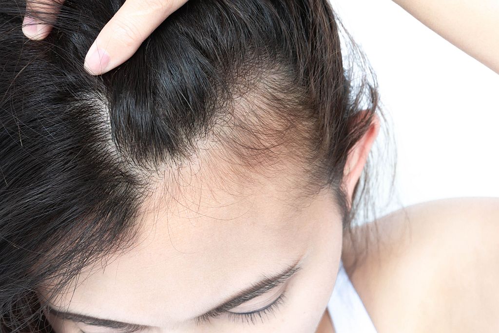 Причины и лечение боли в корнях волос